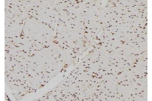 ABIN6269226 at 1/100 staining Human gastric tissue by IHC-P. (DDIT3 Antikörper  (N-Term))