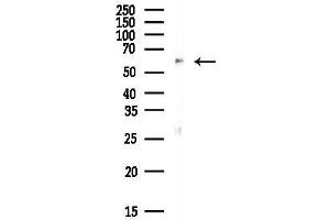 Western blot analysis of lysates from Mouse brain, using PPP3CA Antibody at 1/1000 dilution.