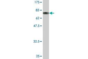 Western Blot detection against Immunogen (83. (YARS Antikörper  (AA 1-528))
