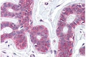 Anti-SLC39A6 antibody  ABIN960811 IHC staining of human breast.