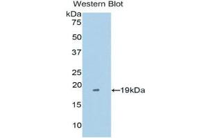 Western Blotting (WB) image for anti-Tumor Necrosis Factor Receptor Superfamily, Member 21 (TNFRSF21) (AA 420-568) antibody (ABIN1176213) (TNFRSF21 Antikörper  (AA 420-568))