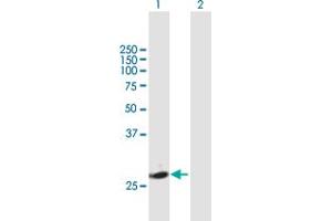 Western Blot analysis of KLK7 expression in transfected 293T cell line by KLK7 MaxPab polyclonal antibody.