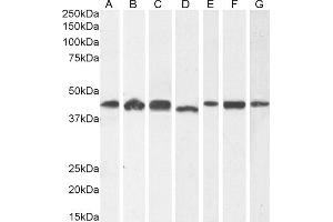 (ABIN185219) (1 μg/mL) staining of A431 (A) and HeLa (B), (2 μg/mL) HEK293 (C) and (0. (ACTR1A Antikörper  (C-Term))