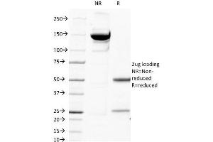 Western Blotting (WB) image for anti-beta-2-Microglobulin (B2M) antibody (ABIN6940411)