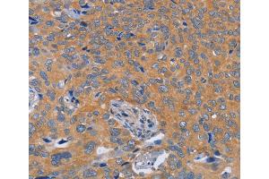 Immunohistochemistry (IHC) image for anti-Biorientation of Chromosomes in Cell Division 1 (BOD1) antibody (ABIN2432731)