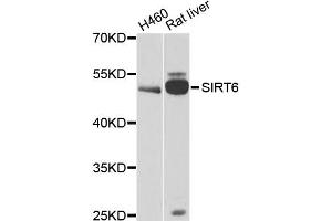 Western blot analysis of extracts of various cell lines, using CALU antibody. (CALU Antikörper)