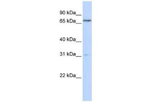 PCCA antibody used at 1 ug/ml to detect target protein. (PCCA Antikörper  (N-Term))