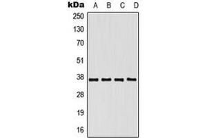 Western blot analysis of hnRNP E1 expression in HeLa (A), K562 (B), SP2/0 (C), PC12 (D) whole cell lysates.