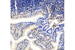 IHC analysis of CD31 using anti-CD31 antibody (ABIN5692990).