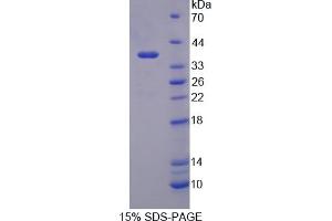 Image no. 1 for Synapsin I (SYN1) (AA 113-420) protein (His tag) (ABIN4989609)