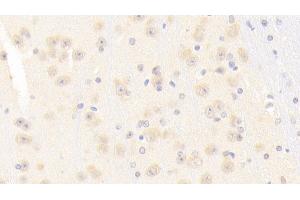 Detection of NOS1 in Mouse Cerebrum Tissue using Polyclonal Antibody to Nitric Oxide Synthase 1, Neuronal (NOS1) (NOS1 Antikörper  (AA 691-826))