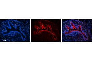 Immunohistochemistry (IHC) image for anti-Cytoskeleton-Associated Protein 4 (CKAP4) (Middle Region) antibody (ABIN2782739)