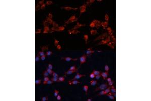 Immunofluorescence (IF) image for anti-Eukaryotic Translation Initiation Factor 3, Subunit B (EIF3B) (AA 100-350) antibody (ABIN6140053)