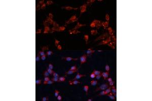Immunofluorescence analysis of NIH-3T3 cells using eIF3B Polyclonal Antibody (ABIN6130364, ABIN6140053, ABIN6140054 and ABIN6214441) at dilution of 1:100 (40x lens). (EIF3B Antikörper  (AA 100-350))