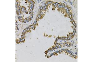 Immunohistochemistry of paraffin-embedded human prostate using EFN Antibody (ABIN6127874, ABIN6139961, ABIN6139962 and ABIN6220974) at dilution of 1:100 (40x lens). (Ephrin A1 Antikörper  (AA 19-182))