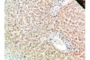 Immunohistochemical analysis of paraffin-embedded human-liver, antibody was diluted at 1:200.