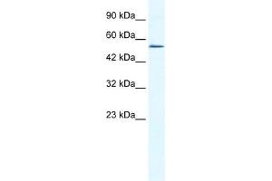 WB Suggested Anti-ZNF286 Antibody Titration:  0.