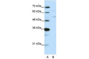 Western Blot showing HNRPK antibody used at a concentration of 1-2 ug/ml to detect its target protein. (HNRNPK Antikörper  (N-Term))