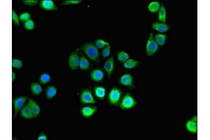 Immunofluorescent analysis of PC-3 cells using ABIN7155150 at dilution of 1:100 and Alexa Fluor 488-congugated AffiniPure Goat Anti-Rabbit IgG(H+L) (Hexokinase 2 Antikörper  (AA 334-526))