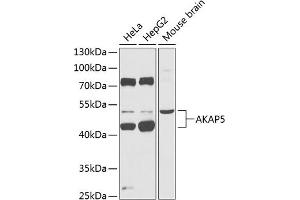 Western blot analysis of extracts of various cell lines, using  Antibody (ABIN6129178, ABIN6136707, ABIN6136709 and ABIN6218330) at 1:1000 dilution. (AKAP5 Antikörper  (AA 1-270))
