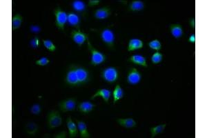 Immunofluorescence staining of A549 cells with ABIN7168752 at 1:77, counter-stained with DAPI. (DVL2 Antikörper  (AA 1-240))