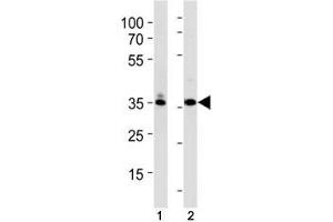 TBP antibody western blot analysis in (1) K562 and (2) U251 lysate. (TBP Antikörper  (AA 210-239))