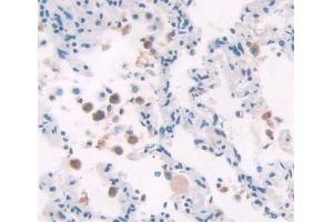 Immunohistochemistry (IHC) image for anti-Polymerase (DNA Directed), delta 1, Catalytic Subunit 125kDa (POLD1) (AA 41-254) antibody (ABIN7444814)