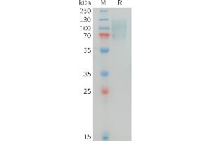 C-Mer Proto-Oncogene Tyrosine Kinase (MERTK) (AA 21-505) protein (His tag)