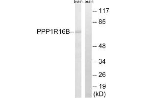 Western blot analysis of extracts from mouse brain cells, using PPP1R16B antibody. (PPP1R16B Antikörper  (Internal Region))