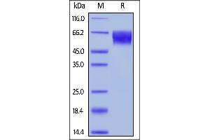 SDS-PAGE (SDS) image for Trophoblast Glycoprotein (TPBG) (AA 32-355) protein (His tag,AVI tag) (ABIN6388260)