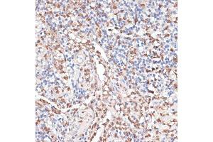 Immunohistochemistry (IHC) image for anti-Cathepsin G (CTSG) (AA 75-190) antibody (ABIN6139228)