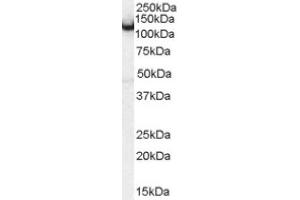 Image no. 1 for anti-Amphiphysin (AMPH) (Internal Region) antibody (ABIN374682) (Amphiphysin Antikörper  (Internal Region))