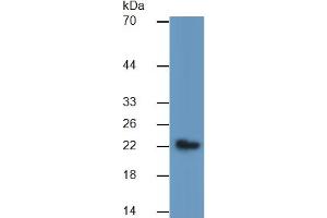 Mouse Capture antibody from the kit in WB with Positive Control: Sample Human Lung lysate;.