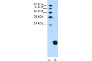 Western Blotting (WB) image for anti-Ribosomal Protein S29 (RPS29) antibody (ABIN2462097)