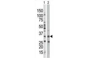 Western Blotting (WB) image for anti-Protein Kinase, AMP-Activated, beta 1 Non-Catalytic Subunit (PRKAB1) antibody (ABIN3002958) (PRKAB1 Antikörper)
