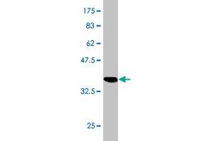 Western Blot detection against Immunogen (36. (FTCD Antikörper  (AA 440-541))