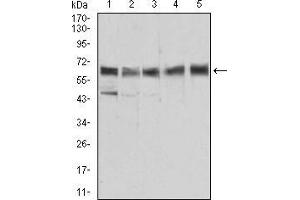 Western blot analysis using ALDH6A1 mouse mAb against Jurkat (1), HEK293 (2), Hela (3), MCF-7 (4), and LNcap (5) cell lysate.