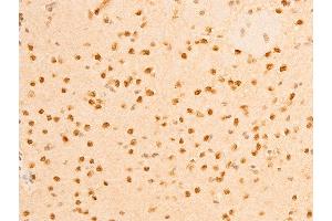 Immunohistochemistry (IHC) image for anti-Lamin A/C (LMNA) (pSer392) antibody (ABIN6256311)