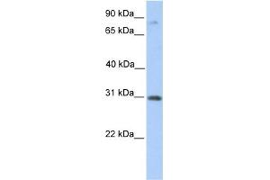 WB Suggested Anti-ABHD13 Antibody Titration:  0. (ABHD13 Antikörper  (C-Term))