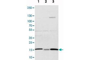 Western blot analysis of cell lysates with ATP5D polyclonal antibody . (ATP5F1D Antikörper)