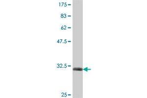 Western Blot detection against Immunogen (32. (SV2B Antikörper  (AA 417-476))