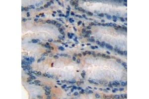 Used in DAB staining on fromalin fixed paraffin-embedded stomach tissue (SCGN Antikörper  (AA 1-276))