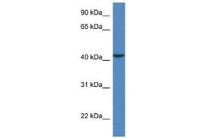 Western Blot showing CAB39L antibody used at a concentration of 1 ug/ml against COLO205 Cell Lysate (CAB39L Antikörper  (N-Term))