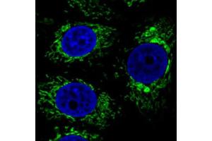 Immunofluorescent staining of MCF7 cells with CS monoclonal antibody, clone CL2545  (Green) shows specific mitochondrial. (CS Antikörper)