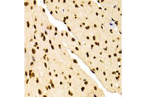 Immunohistochemistry of paraffin-embedded Mouse heart using H3K27me2 antibody at dilution of 1:100 (x400 lens). (Histone 3 Antikörper  (H3K27me))