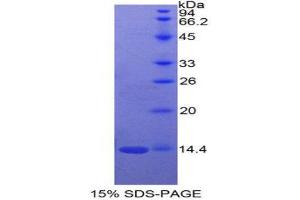SDS-PAGE (SDS) image for Sema Domain, Immunoglobulin Domain (Ig), Short Basic Domain, Secreted, (Semaphorin) 3A (SEMA3A) (AA 580-664) protein (His tag) (ABIN1171330)