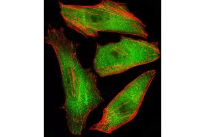 Fluorescent image of Hela cells stained with CFL2 Antibody (C-term) (ABIN6243137 and ABIN6577407). (Cofilin 2 Antikörper  (C-Term))