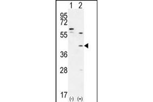 Western blot analysis of TGIF1 (arrow) using rabbit polyclonal TGIF1 Antibody (Center ) (ABIN656000 and ABIN2845379). (TGIF1 Antikörper  (AA 145-174))