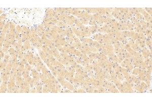 Detection of ST2 in Human Liver Tissue using Polyclonal Antibody to Syntenin 2 (ST2) (SDCBP2 Antikörper  (AA 1-292))
