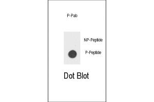 Dot Blot (DB) image for anti-Colony Stimulating Factor 2 Receptor, Beta (CSF2RB) (pTyr766) antibody (ABIN3001760) (CD131 Antikörper  (pTyr766))